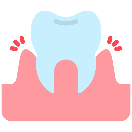 gingivitis-1