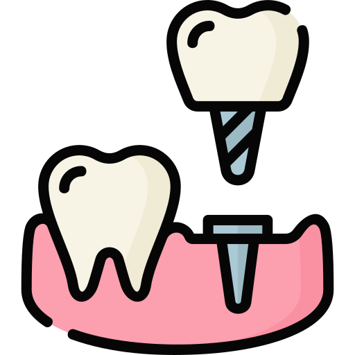 implant-3